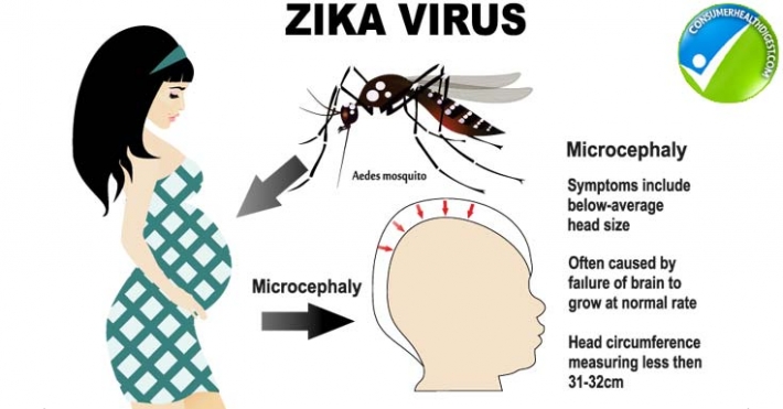 zika-virus-and-pregnancy.jpg